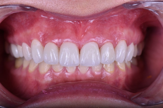 Slider image (9) Care Smile Center